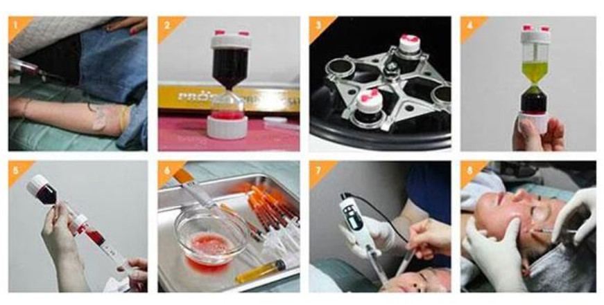 TDL5B Professional PRP Centrifuge Machine Laboratory 50 Ml Centrifuge For Skin Whitening & Beauty Clinics