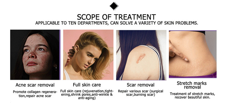 Professional hot sell collagen stimulation fractional skin tightening laser multi function machine