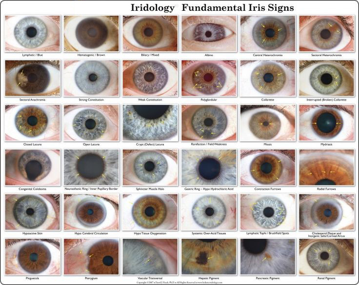 12 MP High Resolution USB Digital Iridology Eye Iriscope Body Health Analyzer