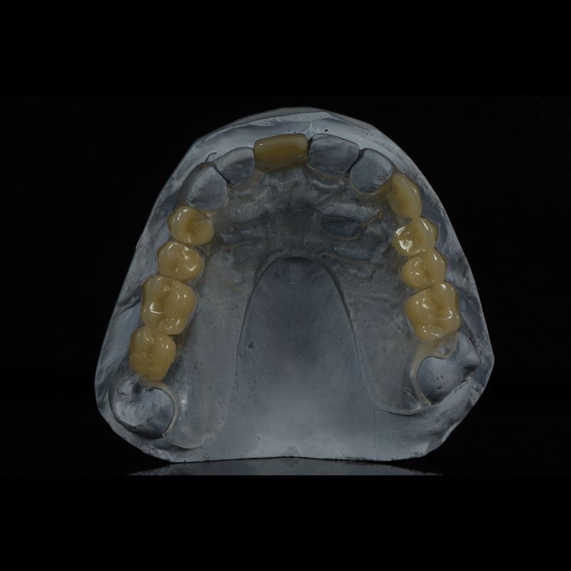 Custom Made Acrylic Removable Partial Denture Single Tooth