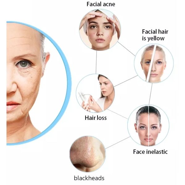 Oxygen Supplement Beauty Salon Equipment Oxygen Facial Machine Skin Tightening