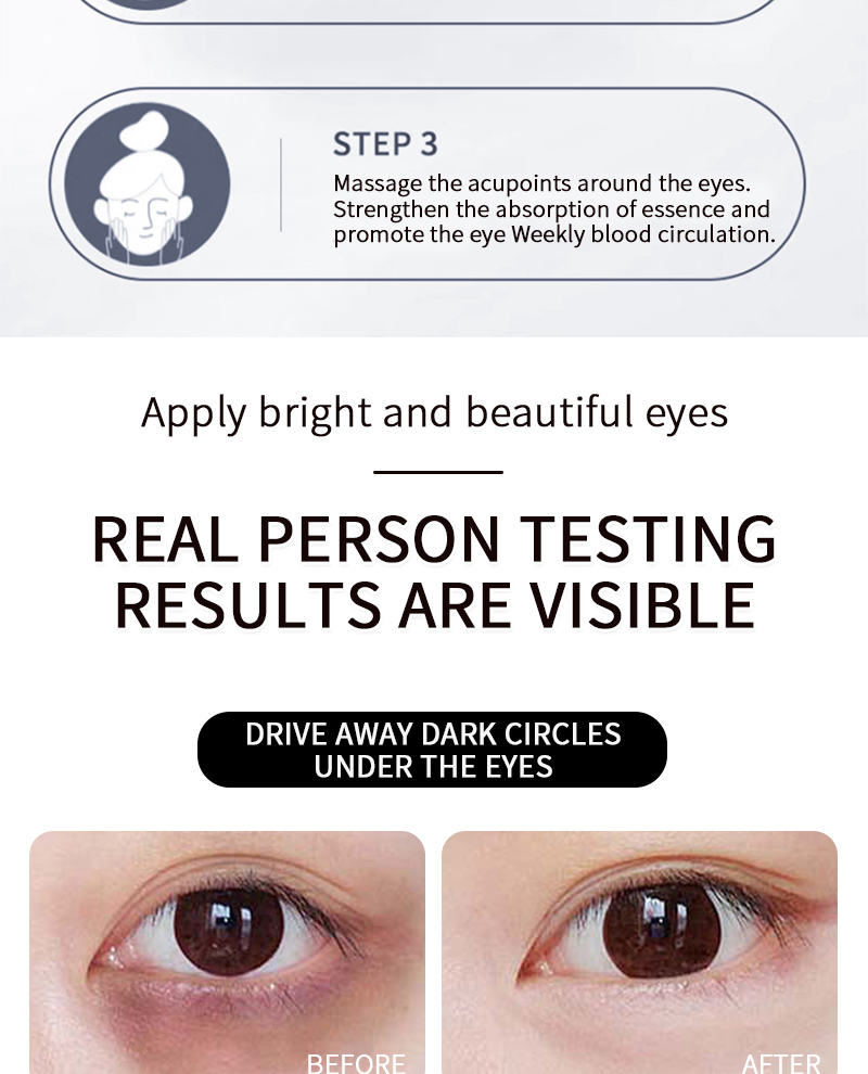 Firming And Moisturizing Reducing Fine Lines Dark Circles And Bag Removal Eye Dark Circles Remove Cream
