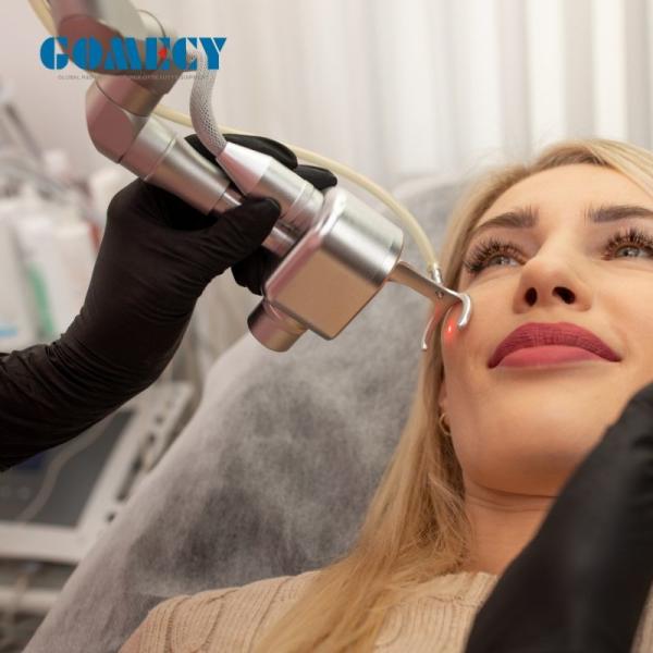GOMECY Fractional CO2 Laser Skin Resurfacing Warts Scars Removing Vaginal