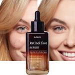 Retinol Face Skin Care Serum Organic Natural Anti Wrinkle Dark Spot Remover