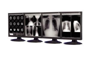 China Anti-reflective Medical Grade Displays used in medical imaging equipment wholesale