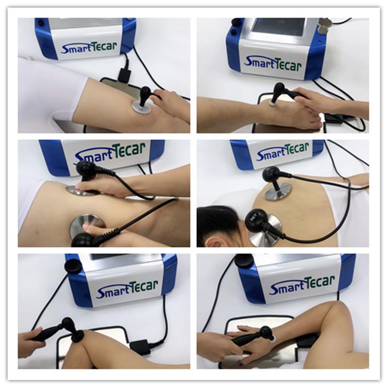 Smart Tecar Therapy Microwave Diathermy Equipment For body Muscle Relax/Heat Treatment Machine