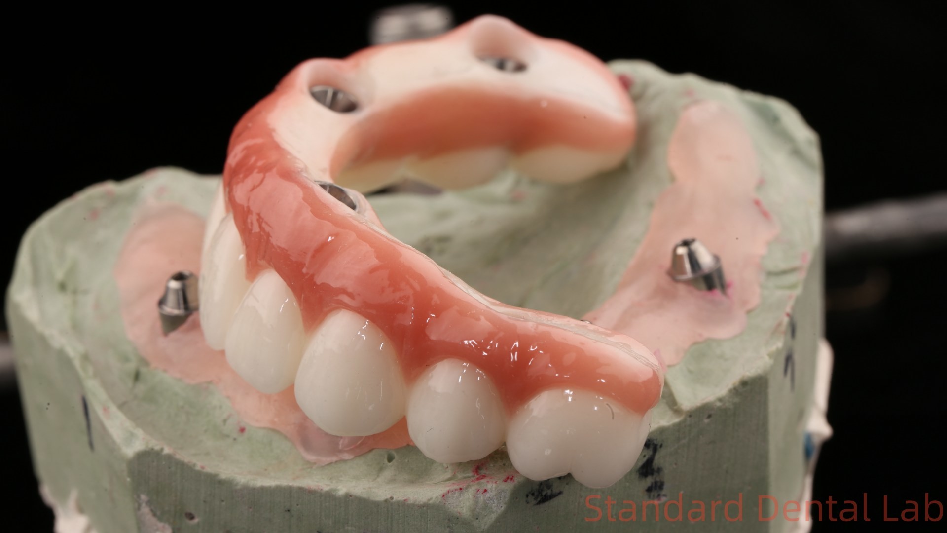 High Quality Dental zirconia crown and All On Four Six Implant Full Arch / China dental lab Manufacturer