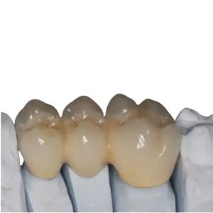 China OEM Customized Zirconia Porcelain Teeth High Strength Durable Beautiful wholesale