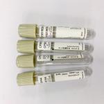 Disposable Blood Test Tube Hospital Used On Glucose Tolerance