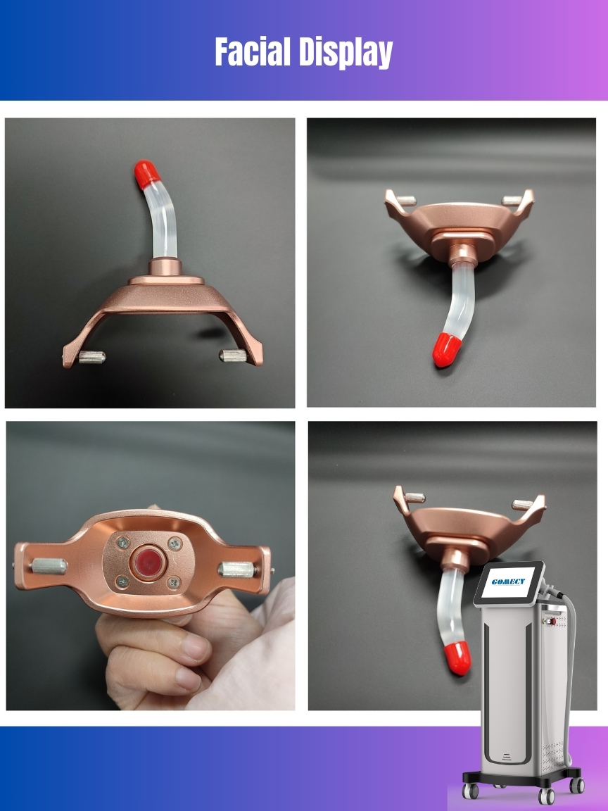 755 808 940 1064nm Diode Laser Hair Removal Device 4 Wavelength with 12*24mm/12*28mm Spot Size