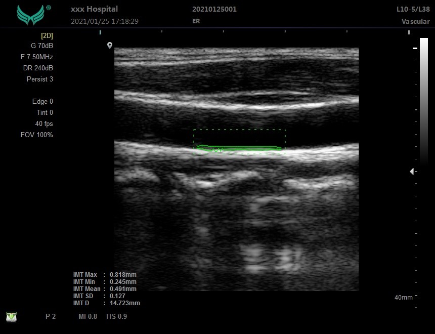 Urology 3D Colour Doppler Ultrasound Machine Scan 12in LCD 120GB