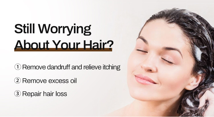 300 ML Private Label Oil Control Natural Plant Hair Growth Anti Hair Loss Shampoo
