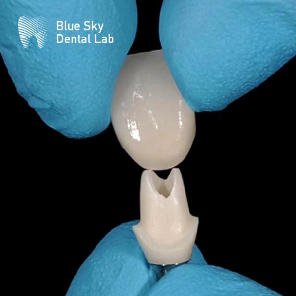 Quality Oral Scan Custom Zirconia Abutment High Strength Zirconia Abutments for sale
