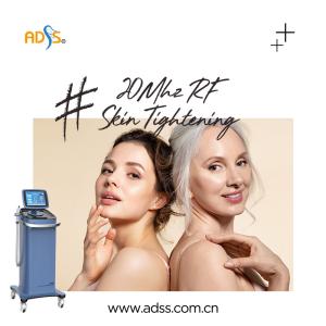 China Skin Tightening Thermage RF Machine 20MHz For Commercial wholesale