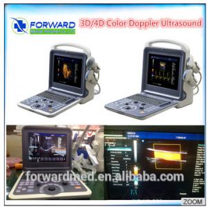 China ultrasound portable color doppler for Heart,echodoppler machine heart desease wholesale