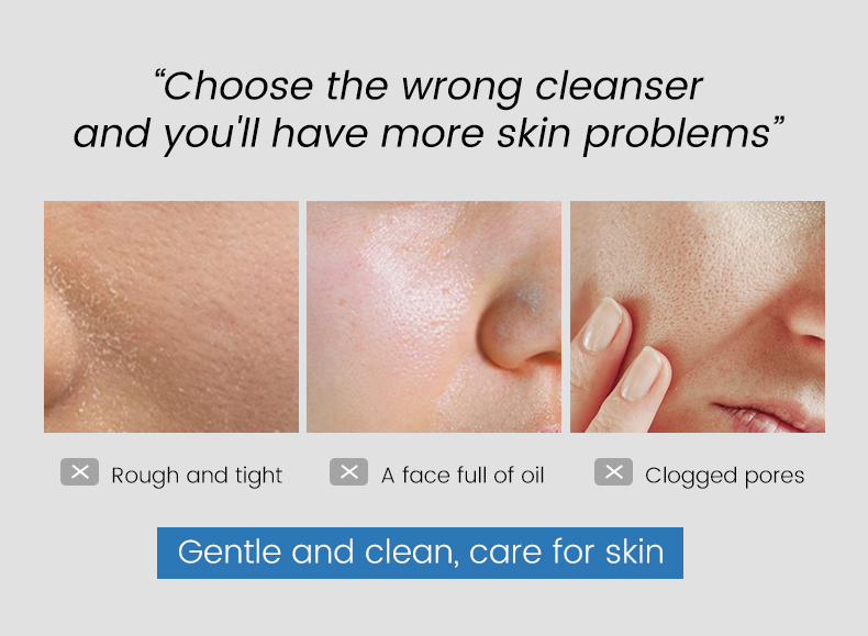 Wholesale Salicylic Acid Soothing Moisturizing Cleanser Refreshing Non Greasy Moisturizing Face Cleanser
