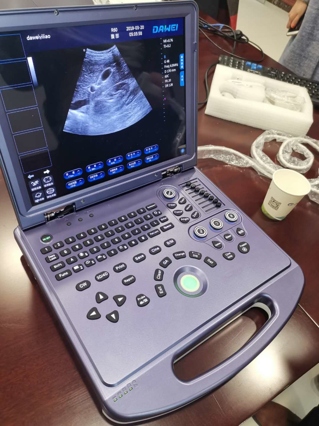 2D Portable Ultrasound Machine With PC Platform AV220V 60Hz