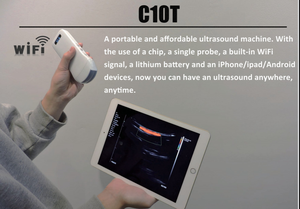 DICOM Medical Hospital Equipments 128 Element Portable Wifi Wireless Ultrasound Scanner