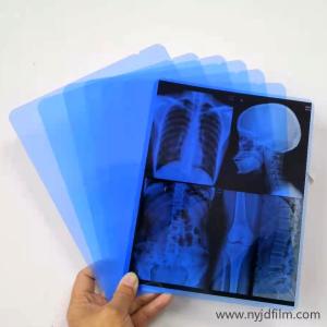 China 13x17 Inch Waterproof Laser Blue X Ray Film For Hospital Radiology Department wholesale