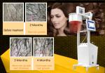 650nm Laser Hair Growth Machine Scalp Treatment Regrowth Salon Equipment
