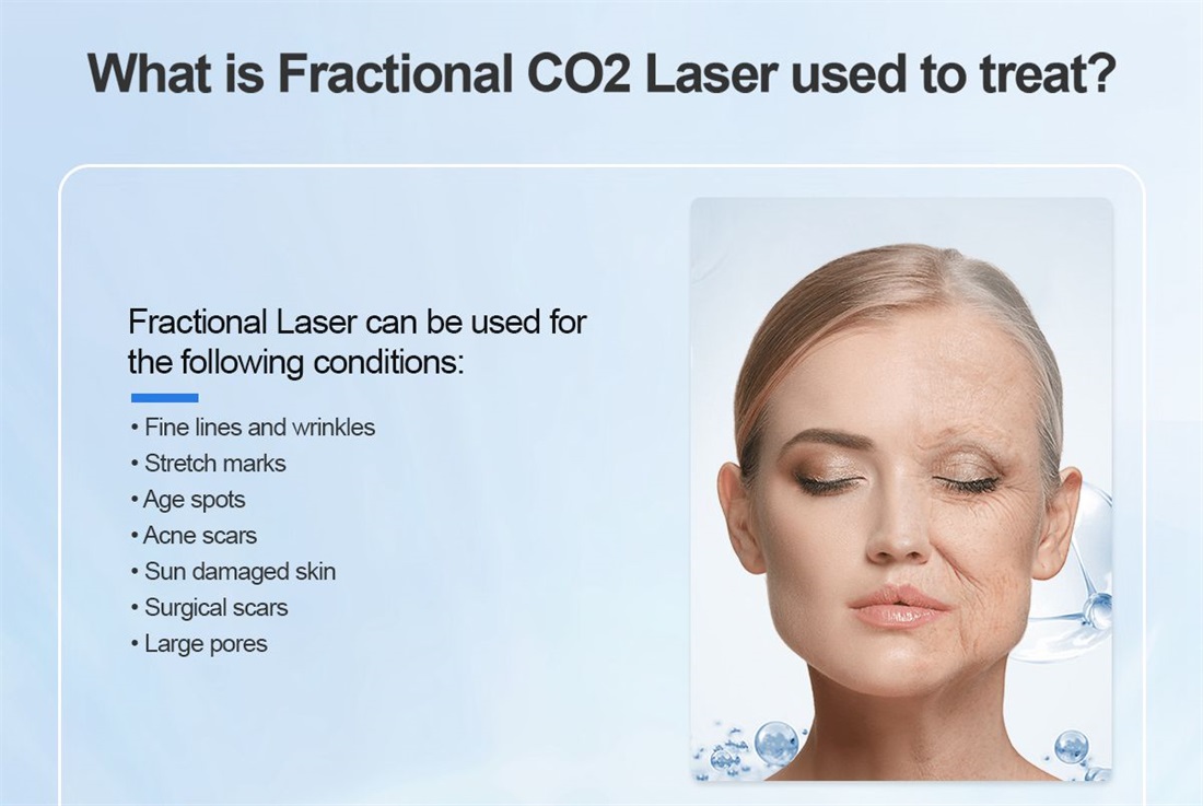 Protable Newest Co2 Fractional Laser/Co2 Surgical Laser Medical Machine