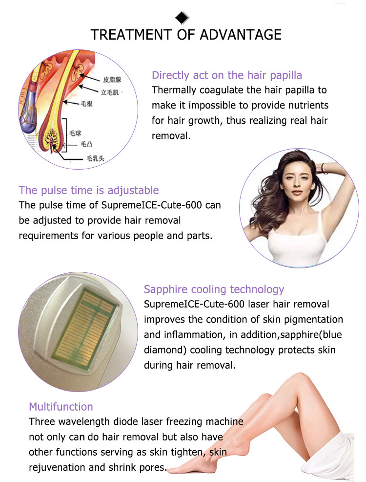 china newest best verticle painfree big spot 3 wavelength smooth skin ce permanent hair removal 755 808 1064 1200w diode