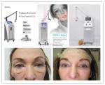 Coherent, USA RF Tube Fractional CO2 Laser Vaginal Tightening/Skin Resurfacing