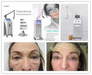 China 2015 Newest and Best fractional co2 laser/co2 fractional laser vaginal tightening wholesale