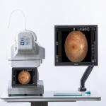 60Hz Automatic Fundu Dual Camera System Intellegent Operation